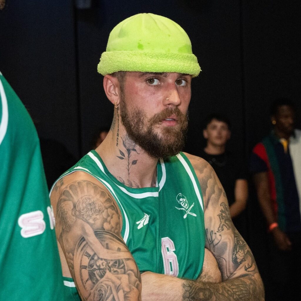 Justin Bieber talks about skateboarding fall and injury