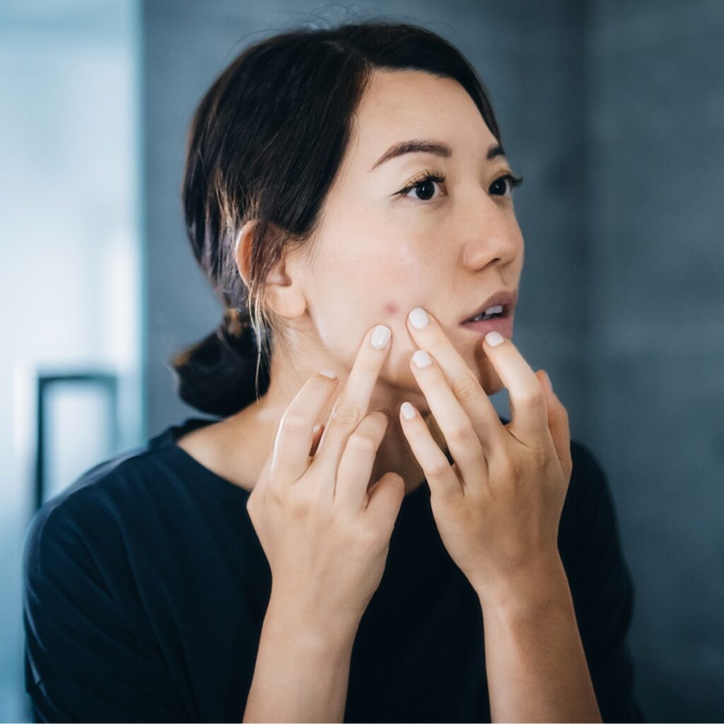 Dr. Derm says you should avoid this skin care mistake as it can lead to summer acne.